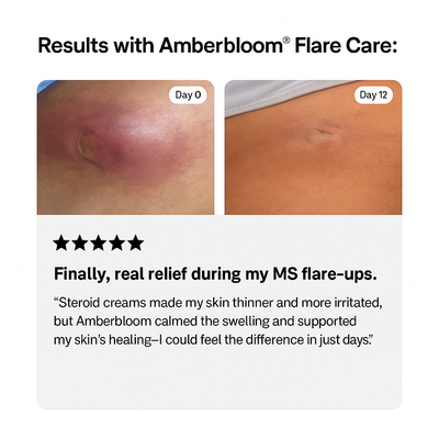 Amberbloom® Flare Care