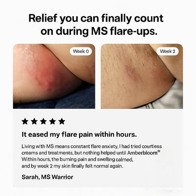 Amberbloom® Flare Care